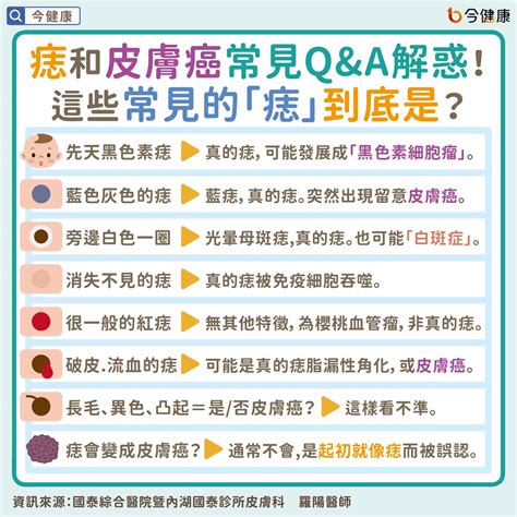 為什麼痣會長毛|是痣？皮膚癌？還是什麼？常見Q&A解惑！醫教揪出「。